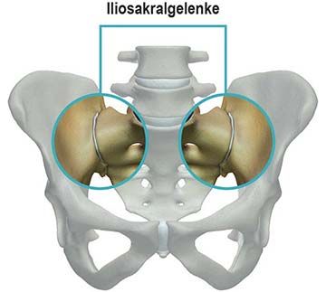 Iliosakralgelenke