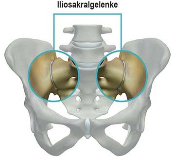 Iliosakralgelenke