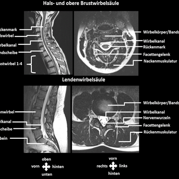 Bilder zur Wirbelsäule